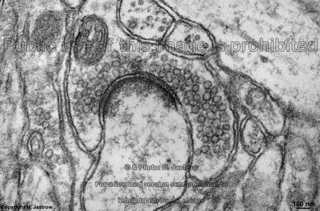 secretory vesicles Dr.Jastrow's electron microscopic atlas