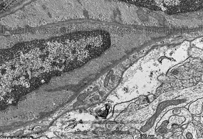 Microscope Nervous Tissue Labeled - Micropedia