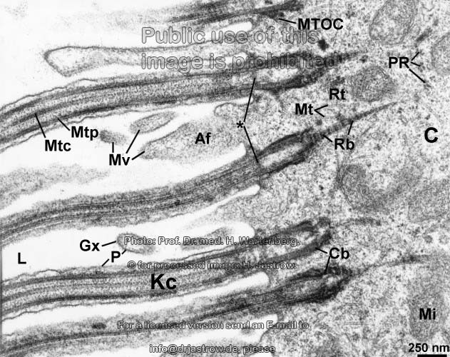 Kinocilia Basal Bodies Trachea Dr Jastrow s Electron Microscopic Atlas